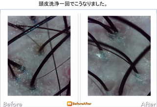 頭皮画像
